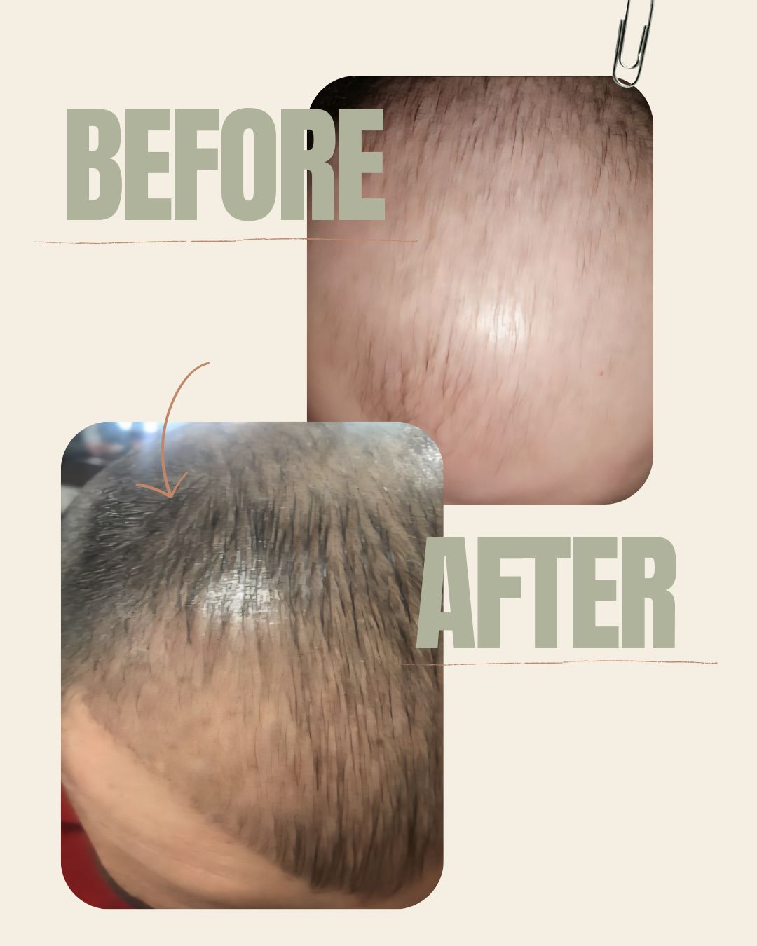 PowerRoot Oil