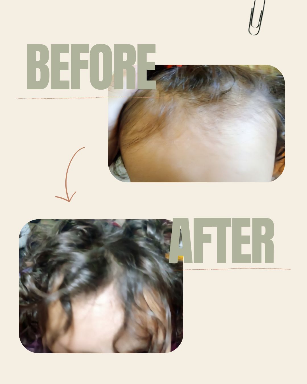 Minoxidil Alternative Hair Mist