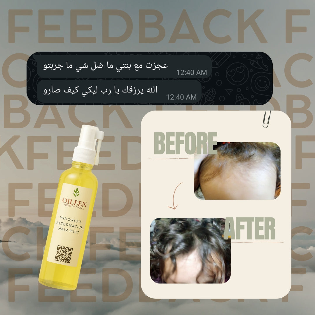 بخاخ بديل المينوكسيديل