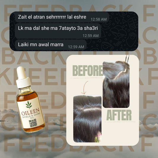 زيت القمل والقشرة